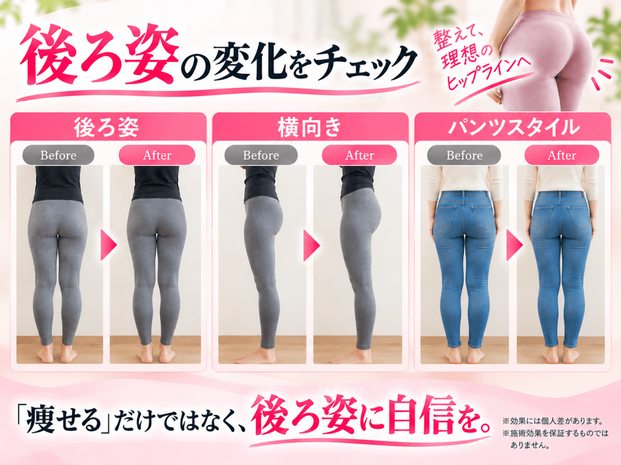 骨盤矯正と磁気パルス施術によるヒップラインの後ろ姿・横向き変化比較