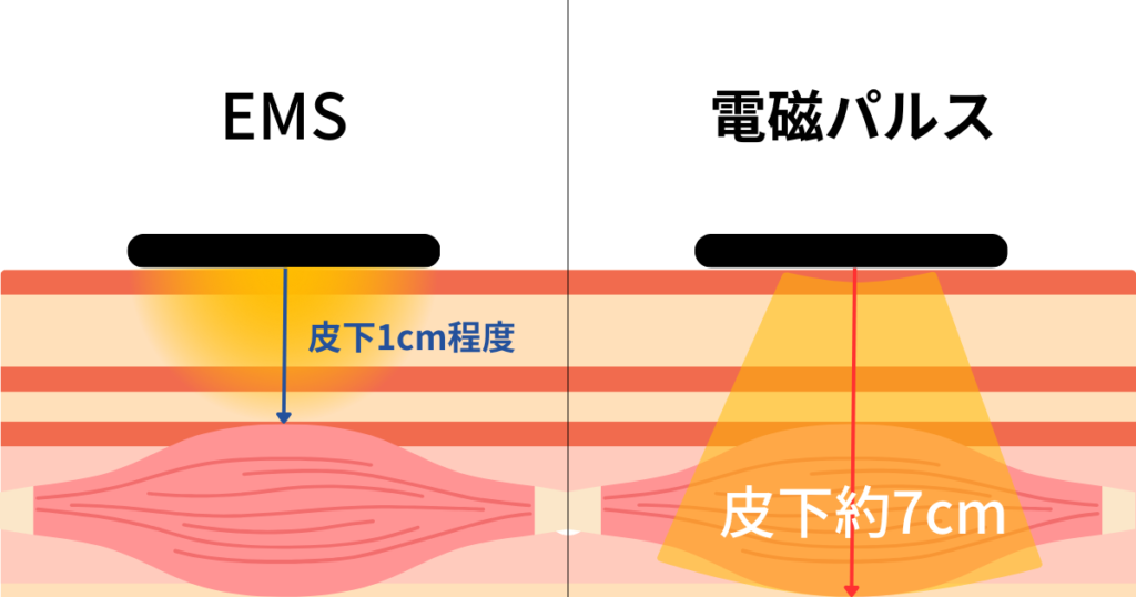 皮下1cm程度にしか届かない従来のEMSの電気刺激と、皮下7cmの深さまで磁場が作用してインナーマッスルをダイレクトに刺激するHIEMT電磁パルス痩身マシーンの違いを比較した解説用のイメージ画像です。