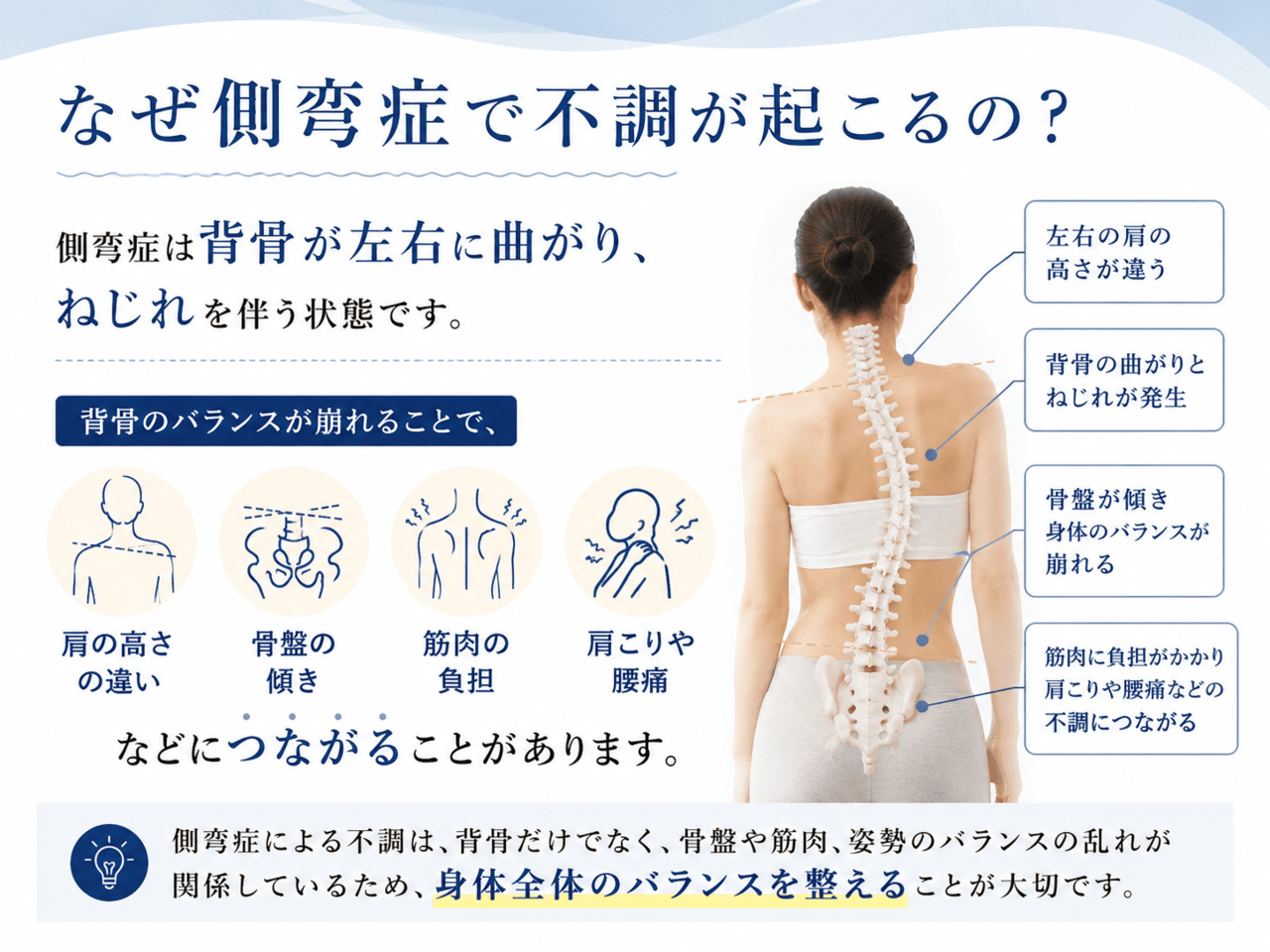 側弯症による背骨のねじれと筋肉の緊張・左右バランスの崩れを示す解説図