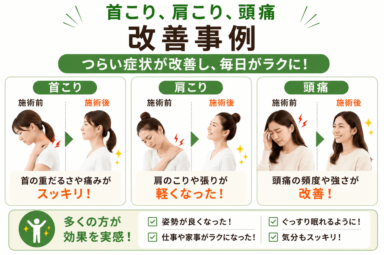 当院の整体施術によって姿勢が劇的に改善し、デスクワーク中の首こりや頭痛から解放された女性のビフォーアフター・イメージ画像