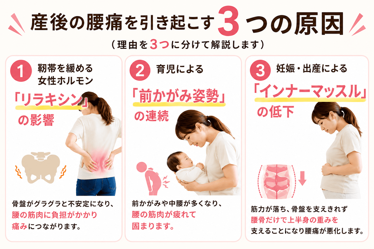 妊娠・出産による腹筋や骨盤底筋の筋力低下と、骨盤が支えきれなくなることで生じる産後腰痛のメカニズムの解説イラスト。