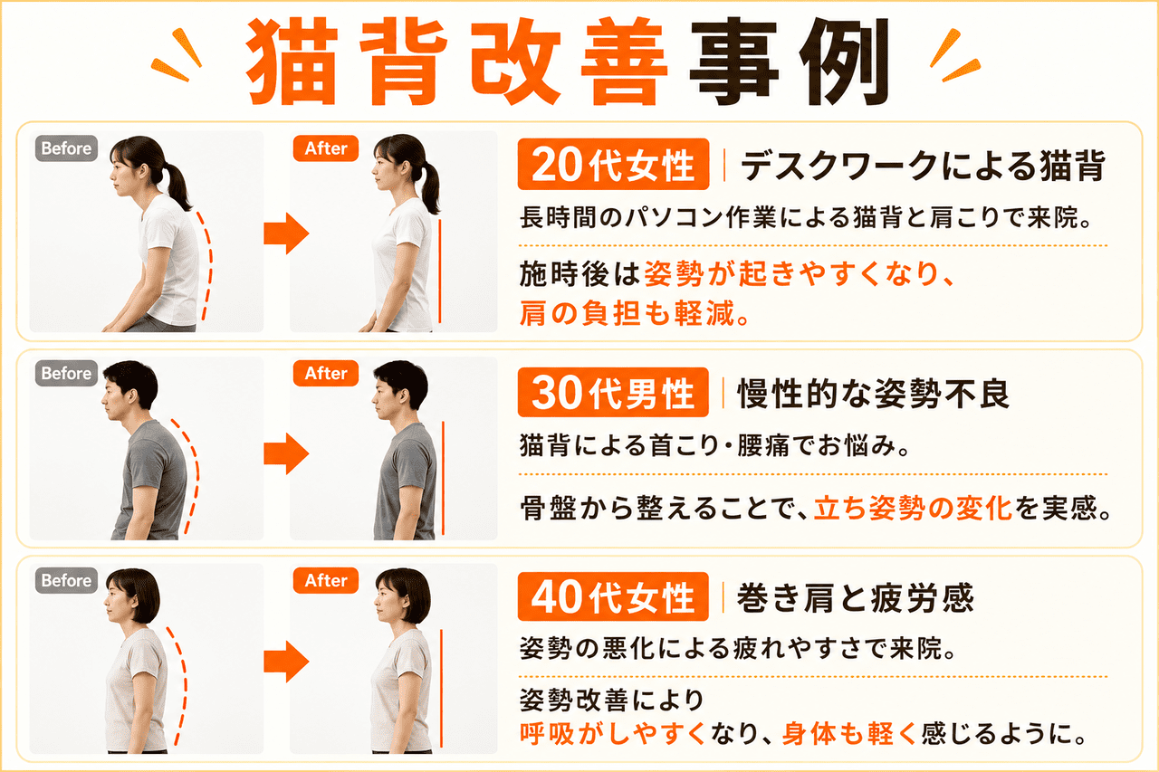 骨盤から整える猫背姿勢矯正コースによる姿勢改善・猫背改善の事例